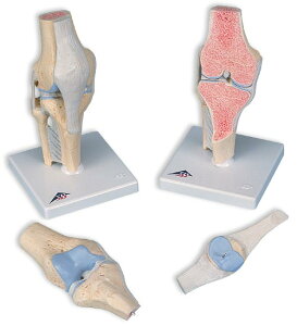 �y���������z�y�������N���k �Ώې��i�z3B�Ё@�֐ߖ͌^ �G�̊֐ߒf��3�������f�� (a89) �l�̖͌^