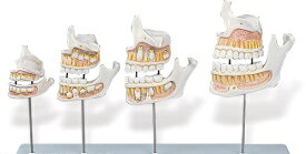【送料無料】【無料健康相談 対象製品】3B社　歯・口腔模型 歯の成長過程モデル実物大 (d20) 人体模型