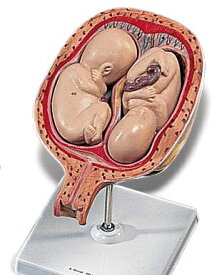 【送料無料】【無料健康相談 対象製品】3B社　妊娠・胎児模型　妊娠5ヶ月の双生児子宮モデル　（l10-7) 人体模型