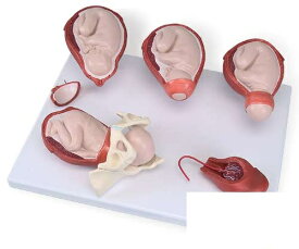 【送料無料】【無料健康相談 対象製品】【特価販売】　3B社　分娩・出産　分娩過程5段階モデル縮尺型　（vg393) 人体模型