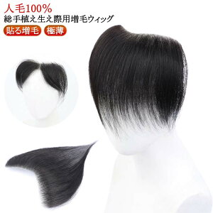 生え際 増毛シート メンズ 部分ウィッグ 貼るウィッグ 生え際 増毛シート 黒 貼る シール M型 脱毛症 ポイントウィッグ 増毛 かつら シール式 脱毛症 ハゲ隠し 対策 男性用 つけ毛 エクステ