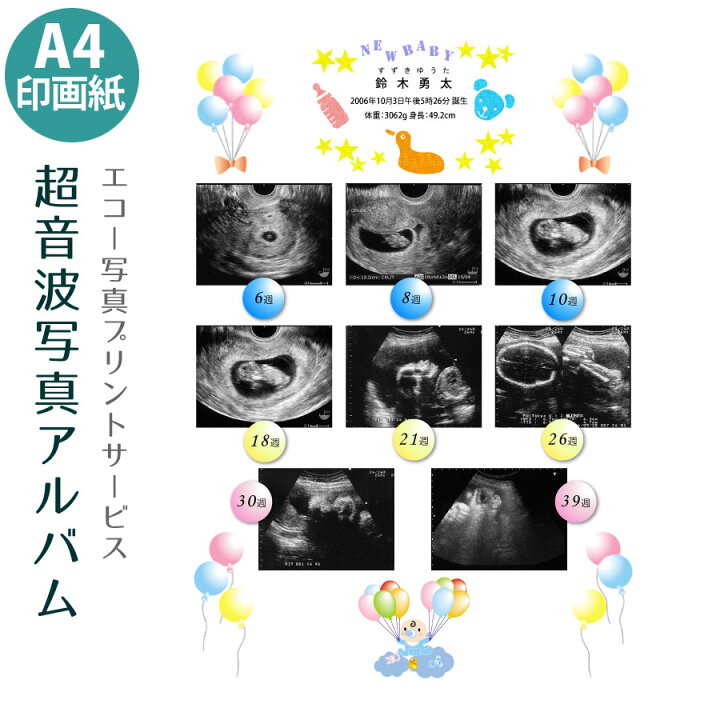 楽天市場 送料無料 超音波写真アルバム バルーン バリュー 赤ちゃんのエコー写真保存プリントサービス 男の子 女の子 手形 足形 データ画像無料プレゼント ブライダル ベビー シセイル