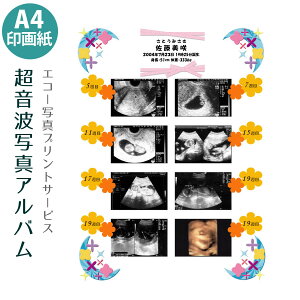 エコー写真 アルバム プレゼント マタニティ小物の通販 価格比較 価格 Com