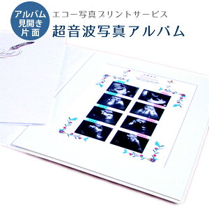 エコー写真 アルバム プレゼント マタニティ小物の通販 価格比較 価格 Com