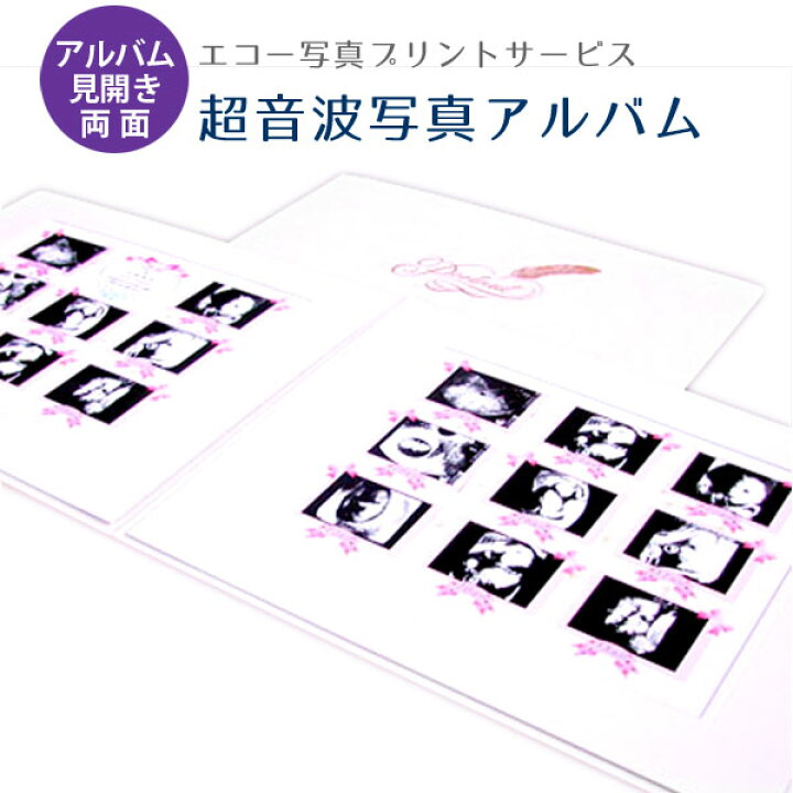 送料無料 超音波写真アルバム 男の子 赤ちゃんのエコー写真プリントサービス ナチュラル