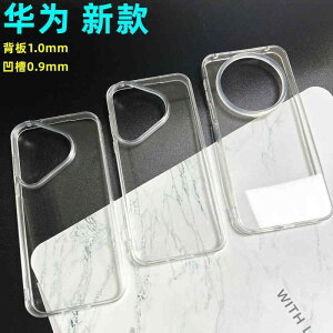 Huawei p 80 pro / mate 80 pro �a �t�� �ڒ� �� DIY �f�� �P�[�X�A Xiaomi 17 pro �a �t�� �g�� �d�b �P�[�X�� �K�p