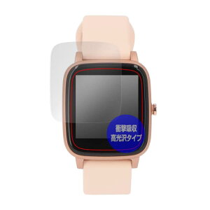 �~���r�b�N�X PROJECT-EE �X�}�[�g�E�H�b�` EastEnd001 �p �Ռ��z�� ���� �R�� �ی� �t�B���� �h�w�� �h�C�A ���{�� OverLay Absorber