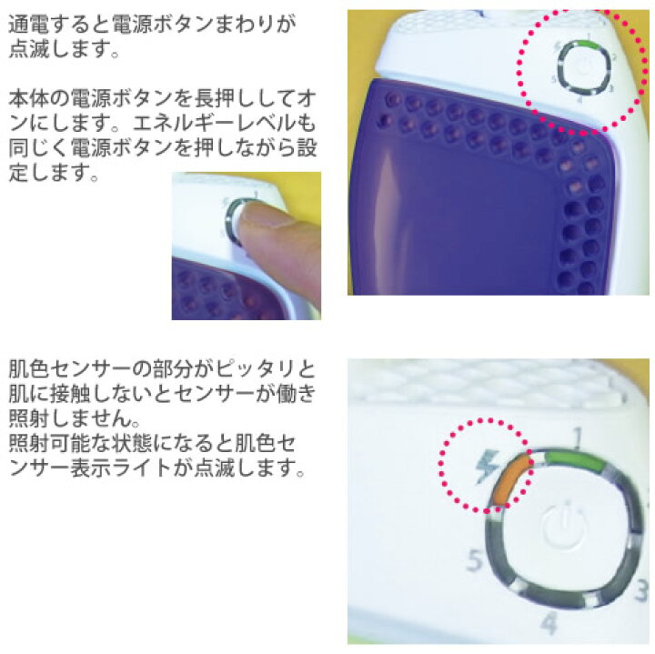 楽天市場】センスエピX 【送料無料】 : ナデシコの森