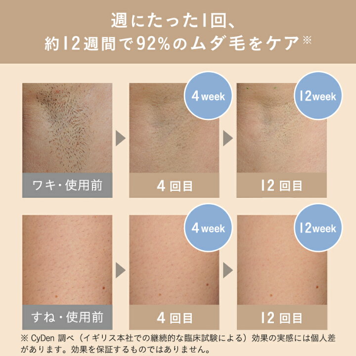 楽天市場】【クーポン利用で32%OFF！】光脱毛器 痛みレス コンパクト  