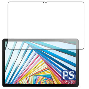 PDAH[ Lenovo Tab M10 Plus (3rd Gen)Ή PerfectShield ی tB ˒ጸ hw {