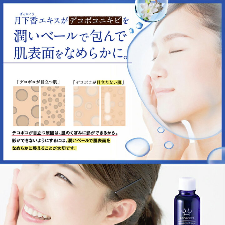 楽天市場 ニキビ ケア 化粧水 ニキビ跡 消し クレーター 薬用アクレケア 3本セット 医薬部外品 総健美舎