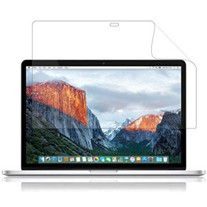 TCYF MacBook Pro 15 (2016N10ȑO) LOE(G)  MacBook Pro 15 (2015) یtB ܂œ\ĂȂ̂悤ɔ  ɒᔽ SARtB (15C` 2016N10ȑO