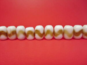 y`xbgVzՉV16×10mmy4SETz