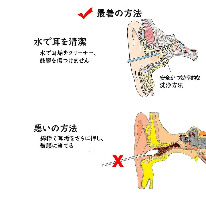楽天市場 ワンダフルデーp11倍 クーポン 送料無料 耳洗浄器 耳清潔 耳掃除 耳垢清潔キット 耳ケア 耳クリーナー 耳かき 耳垢取り 耳垢栓塞 水 ホワイト 500ml サンシャイン ストア