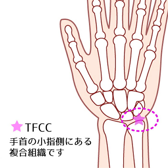 【竹虎公式】竹虎ソフラウルファーTFCC全3色フリー/XLTFCC固定バンド左右兼用