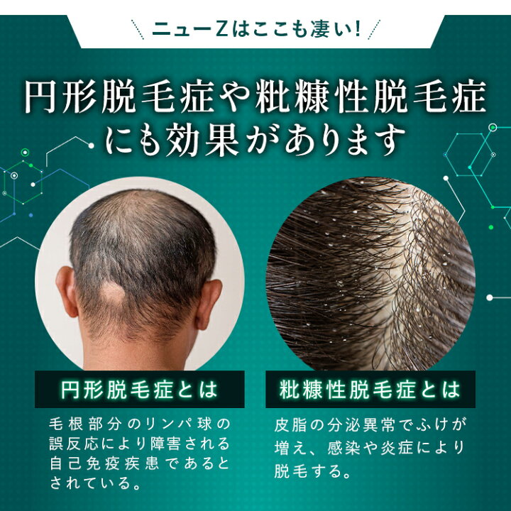 楽天市場】【第2類医薬品】【公式】ニューZ 60ml AGA治療薬 第2類 