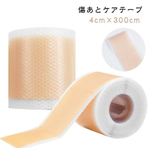ՃPAe[v 鉤؊J \Snɂ Ő؂^Cv VRe[v e[v یe[v B PCh 4cm×300cm 鉤؊J  e[v   p PA VR[