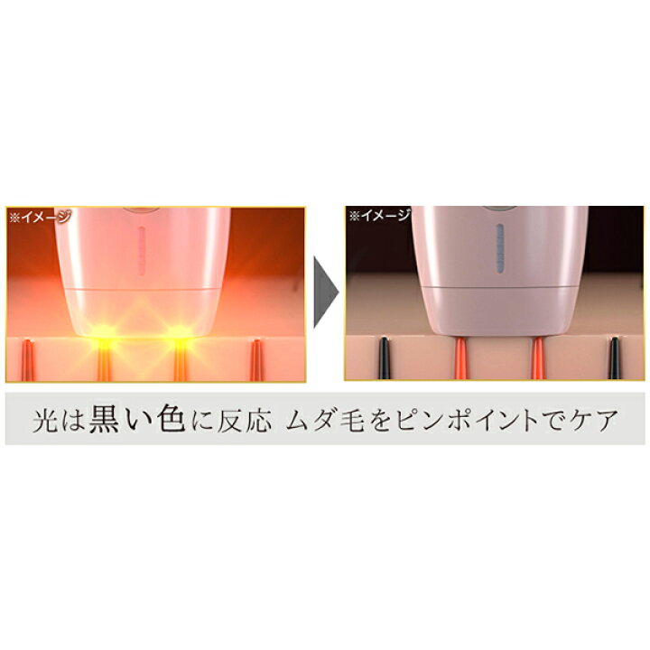 楽天市場】MEスマートエピレーションプレミアム ／ ムダ毛ケアアイテム 
