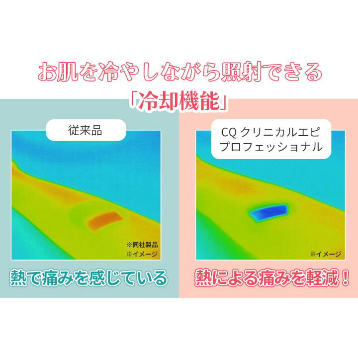 楽天市場】CQ クリニカルエピプロフェッショナル ／ ムダ毛  
