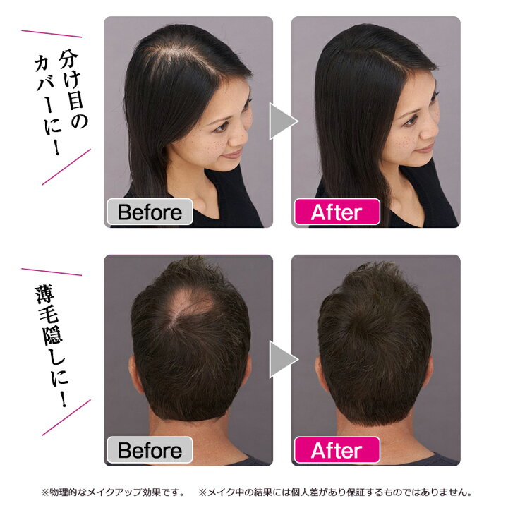 楽天市場 Toppik トピック 3dヘアコンシーラー スターターキット ヤーマン Toppik 白髪 薄毛 ポイント ヘア カラー パウダー ミスト簡単 Tbsショッピング Tbsショッピング 楽天市場店