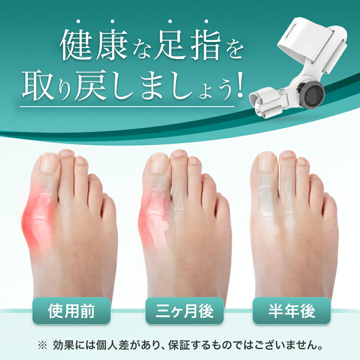楽天市場】【P15倍+300円クーポン】外反母趾 医師監修 足指 