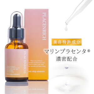 y[5cmzet vZb` u[X^[ yAZ 30ml st vZ^ et }vZ^ XLPA WPA GCWOPA q N W΍