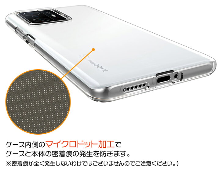 楽天市場】【P10倍+10％OFFクーポン！】 Xiaomi 11T / Xiaomi 11T Pro 