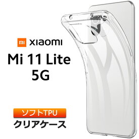 Xiaomi Mi 11 Case