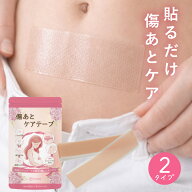 【医師＆助産師監修】 傷あとケアテープ 帝王切開 手術後 シリコン 100% テープ 傷跡 保護 防水 紫外線カ…