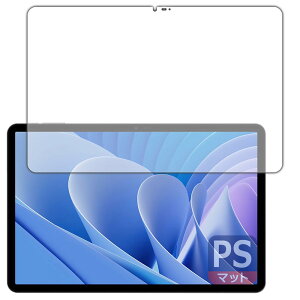 PDAH[ DOOGEE T30 Pro Ή PerfectShield ی tB ˒ጸ hw {