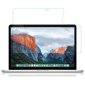 LOE(G) R u[CgJbg  MacBook Pro 15 (2015) یtB ˖h~ FČ₷𑹂ȂȂ { tB ( }bNubNv 15C` Retina)