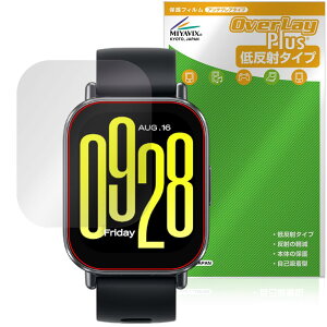 ~rbNX Xiaomi Redmi Watch 5 Active Ή ی tB ˖h~ hw hCA {