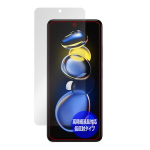 ~rbNX Xiaomi Redmi Note 11T Pro p בΉ ˖h~ ی tB hw hCA { OverLay Plus Lite