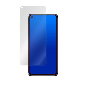 ~rbNX Xiaomi Redmi Note 9T 5G p tیtB hw hCA { OverLay Brilliant OBXIAOMIREDMINOTE9T/12