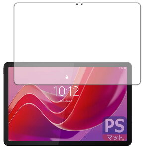 PDAH[ Lenovo Tab B11 Ή PerfectShield ی tB [ʗp] ˒ጸ hw {