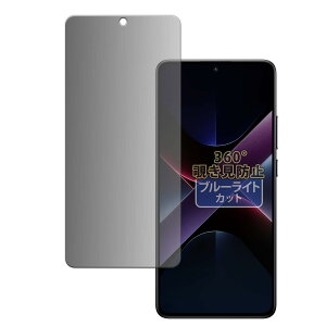 Kayo&Karin Xiaomi POCO X7 Pro  vCoV[tB 360x ̂h~ tB u[CgJbg ˒ጸ {