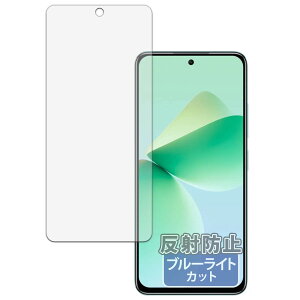 Kayo&Karin OUKITEL C58 / C58 Pro p یtB ȖʑΉ u[CgJbg tB ˒ጸ {