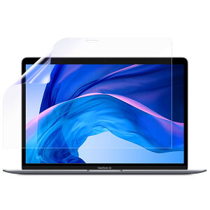 ClearView MacBook Pro 13 (2022 M2/2020 M1) /MacBook Air 13 (2020 M1)Ή t  ی tB }bg ˒ጸ ^Cv }bNubN ʃtB {