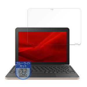 MotoMoto tB dynabook K70/HX p یtB u[CgJbg ˒ጸ {