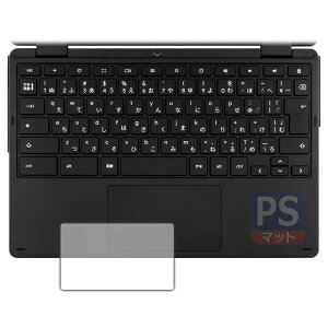 PDAH[ aiwa Chromebook S11 (JA4-LPC1101) Ή PerfectShield ی tB [^b`pbhp] ˒ጸ hw {