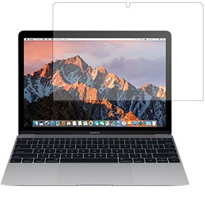 ClearView(NAr[) Apple MacBook 12C` 2017NfΉ t ی tB  ׂ R RECX ^Cv