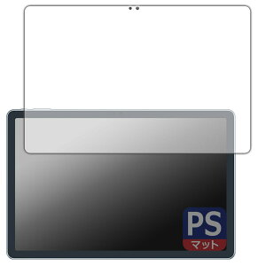 PDAH[ ALLDOCUBE iPlay 60 Pro Ή PerfectShield ی tB [ʗp] ˒ጸ hw {
