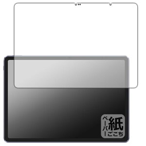 PDAH[ XP-Pen Magic Drawing Pad Ή ɏ悤ȕ`Sn ی tB [ʗp] ˒ጸ {