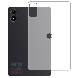 PDAH[ ALLDOCUBE iPlay 70 mini Ultra Ή PerfectShield Plus ی tB [wʗp] ˒ጸ hw {