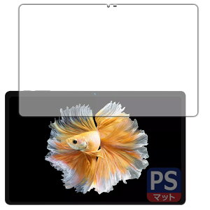 PDAH[ BMAX MaxPad I11 Power Ή PerfectShield ی tB [ʗp] ˒ጸ hw {