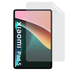 JP�t�B������吻���� Xiaomi Pad 5�p�ی�t�B���� �V���I�~�p�b�h5 �t�B���� [�u���[���C�g�J�b�g�E���˖h�~�E�A���`�O���A] �w��h�~ �R�� �C�A���X �����z��