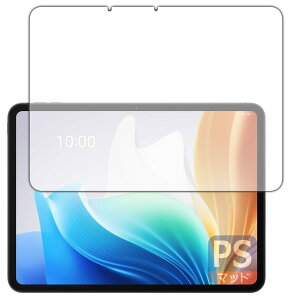 PDA�H�[ OPPO Pad Neo �Ή� PerfectShield �ی� �t�B���� [��ʗp] ���˒ጸ �h�w�� ���{��