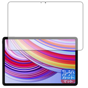 PDA�H�[ Xiaomi Redmi Pad Pro �Ή� �u���[���C�g�J�b�g[���˒ጸ] �ی� �t�B���� ���{��