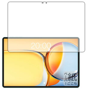 PDAH[ Teclast P50 AI Ή ɏ悤ȕ`Sn ی tB [ʗp] ˒ጸ {