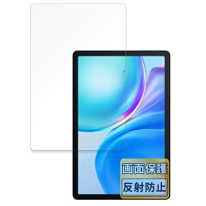 FILMEXT �t�B���� Blackview Tab 90 WiFi �p ���˒ጸ �ی�t�B���� �w��h�~ ���{��